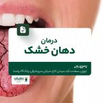 درمان دهان خشک