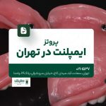پروتز ایمپلنت در تهران