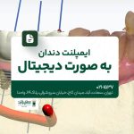 ایمپلنت دندان به صورت دیجیتال