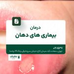 درمان بیماریهای دهان
