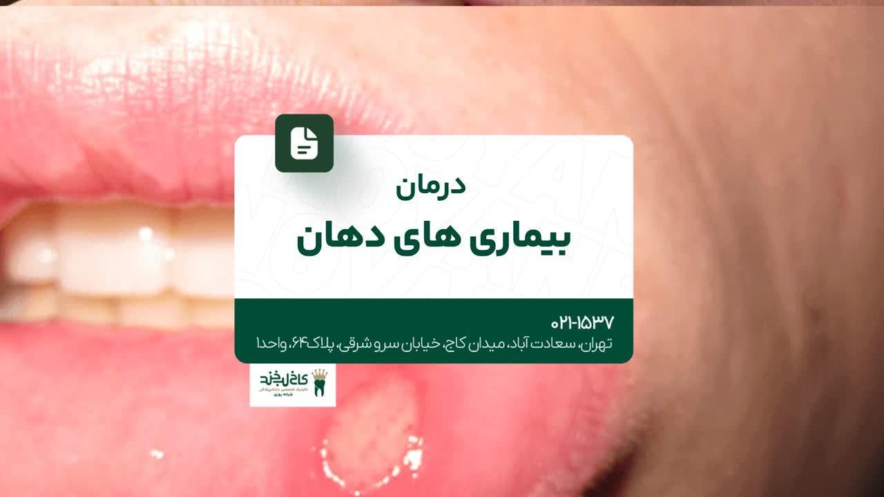 درمان بیماریهای دهان