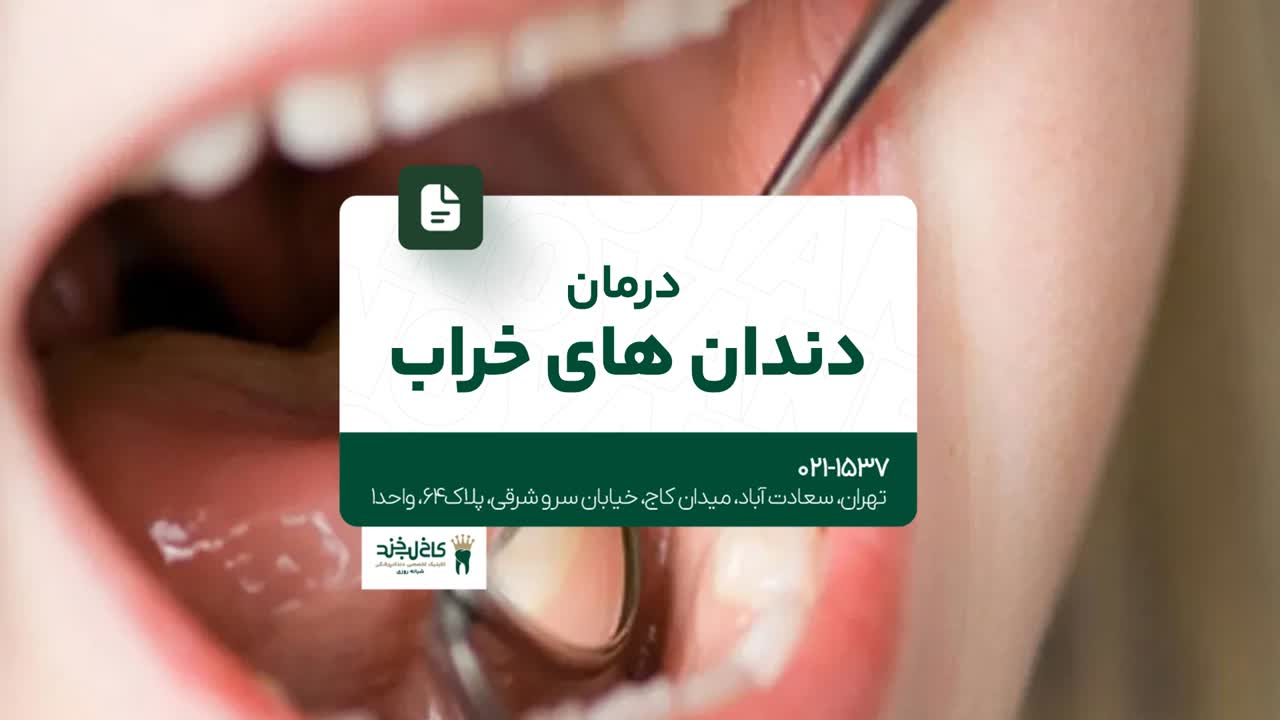 درمان دندانهای خراب