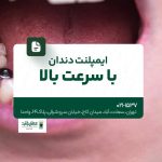 ایمپلنت دندان با سرعت بالا