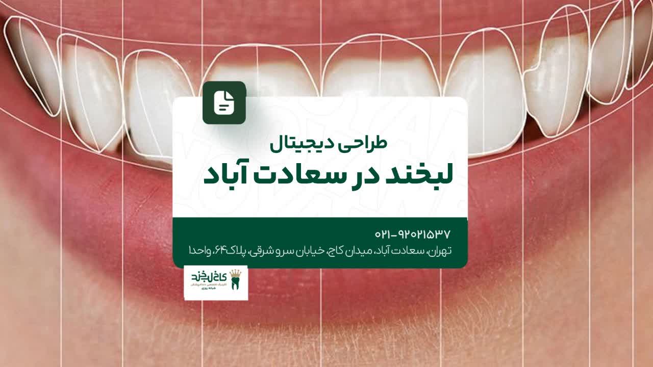 طراحی دیجیتال لبخند در سعادت آباد طراحی دیجیتال لبخند در سعادت آباد