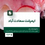 ایمپلنت سعادت آباد