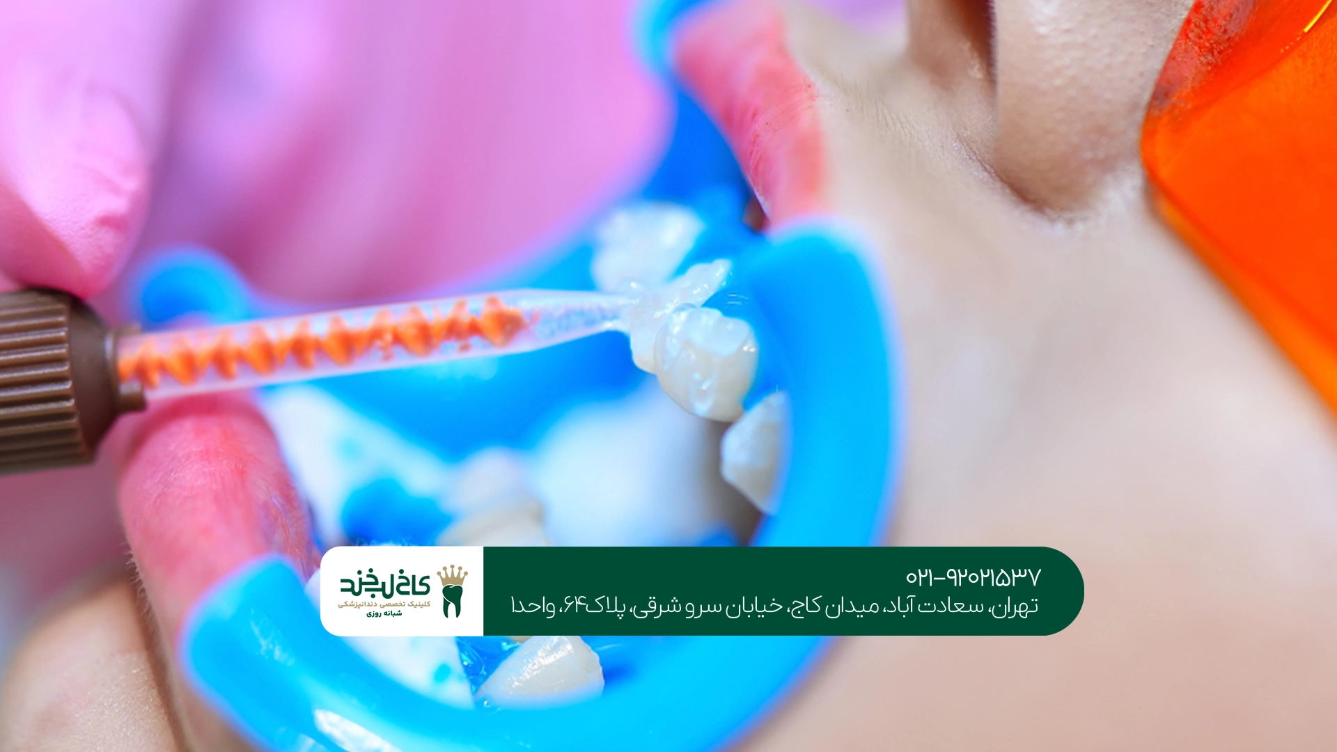 کلینیک دندانپزشکی کاخ لبخند کجاست؟ کلینیک دندانپزشکی کاخ لبخند کجاست؟