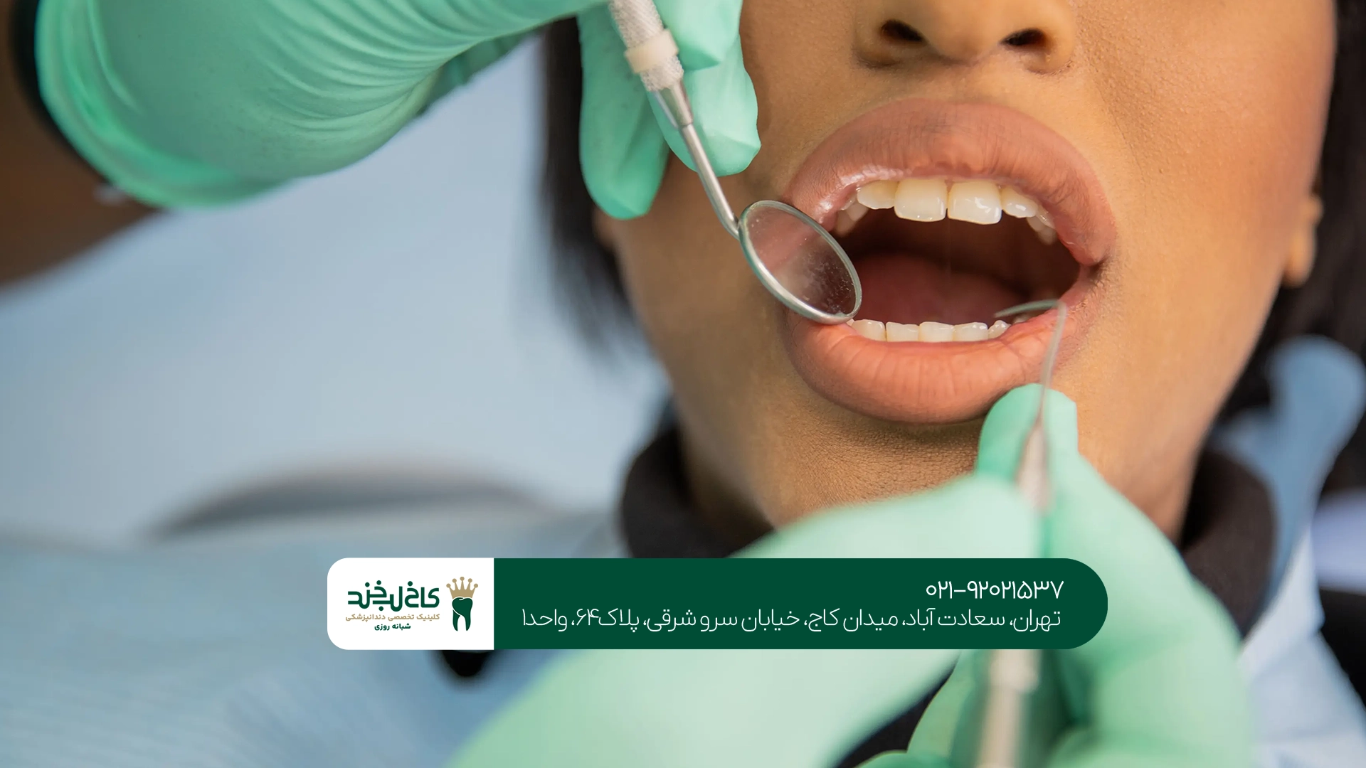 کلینیک دندانپزشکی کاخ لبخند کجاست؟ کلینیک دندانپزشکی کاخ لبخند کجاست؟