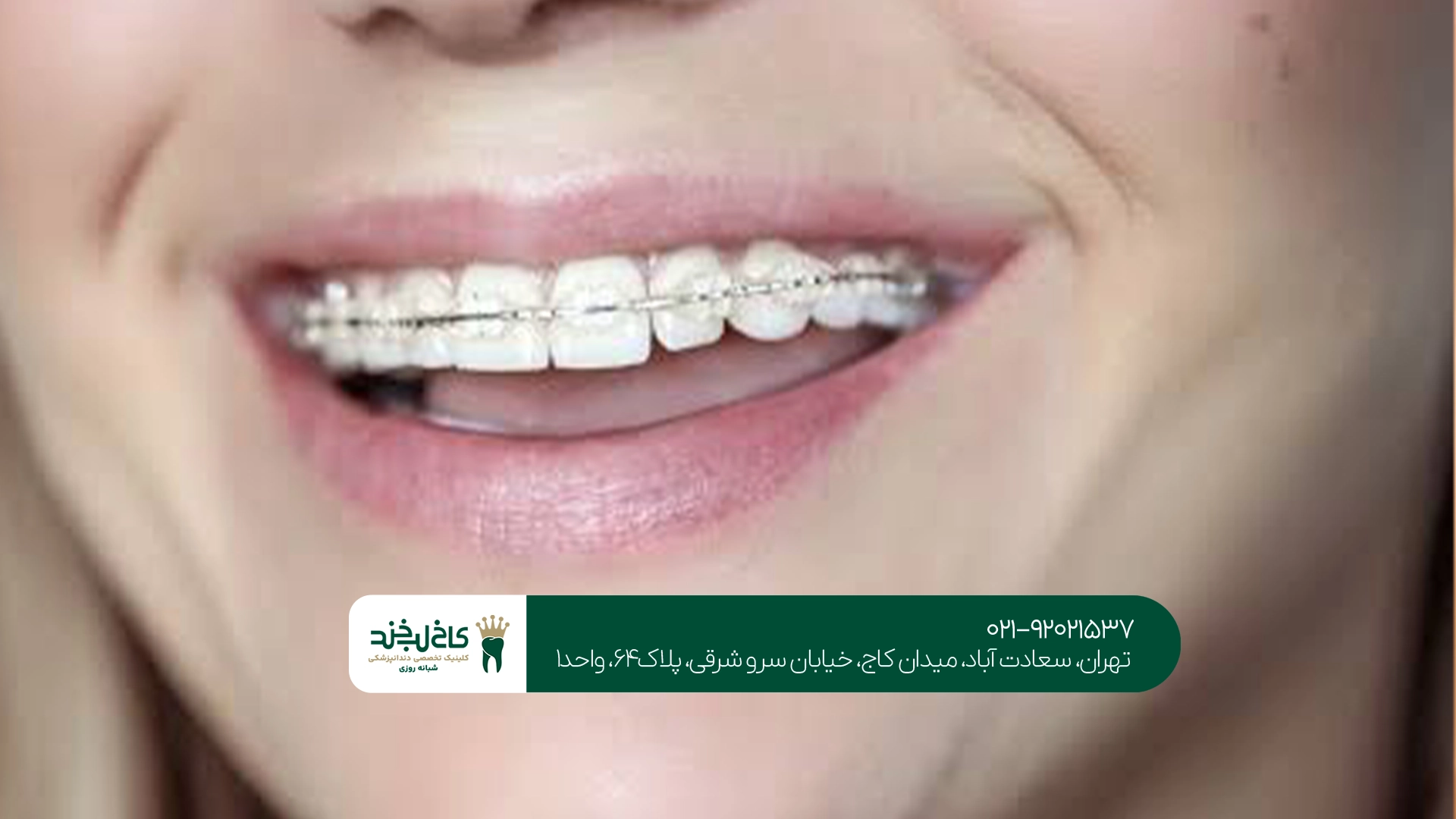 تفاوت درد ارتودنسی در کودکان و بزرگسالان چیست؟