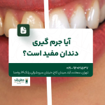 آیا جرم گیری برای دندان مضر است