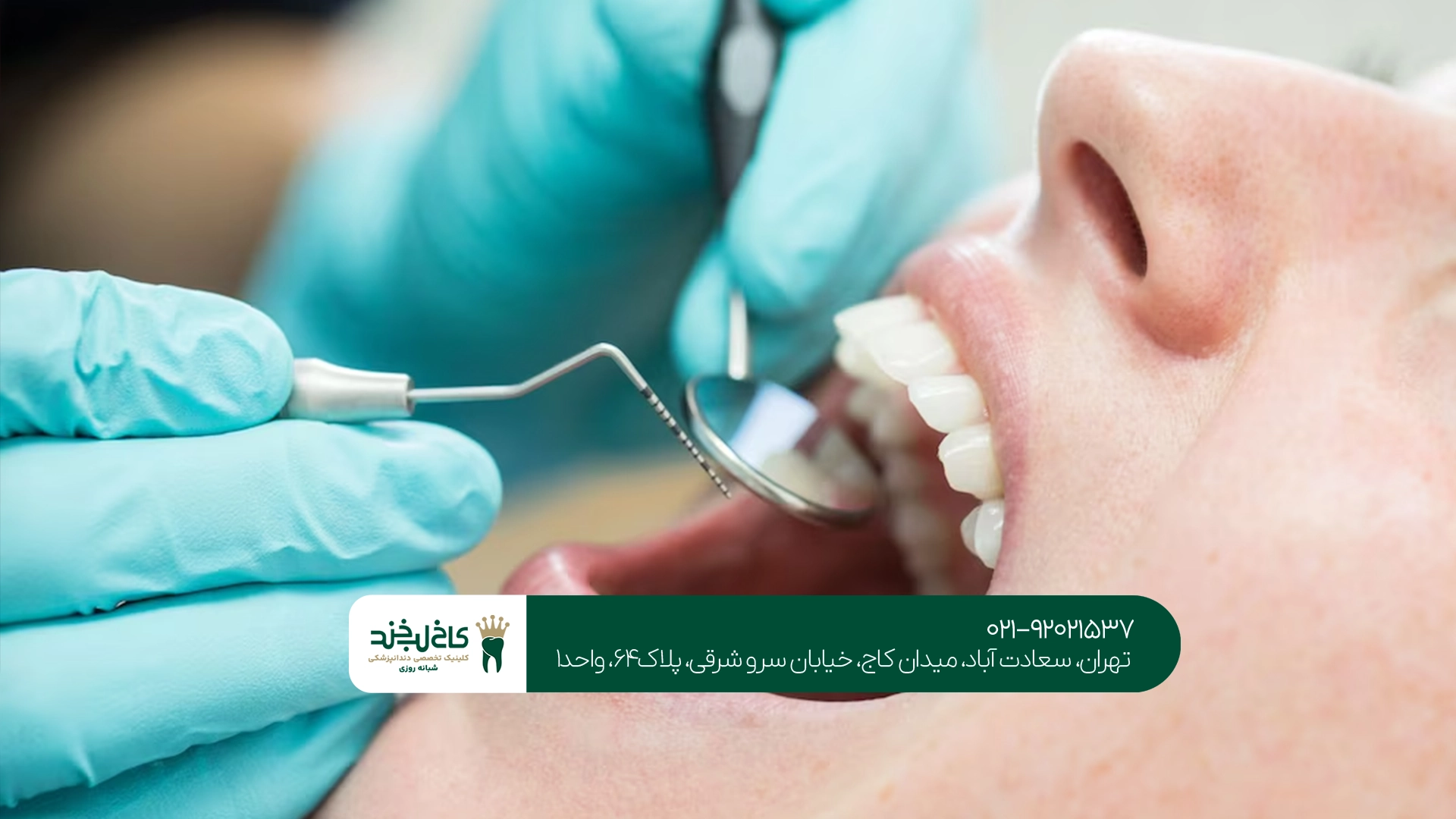 جرمگیری دندان چقدر به مینای دندان آسیب میزند؟