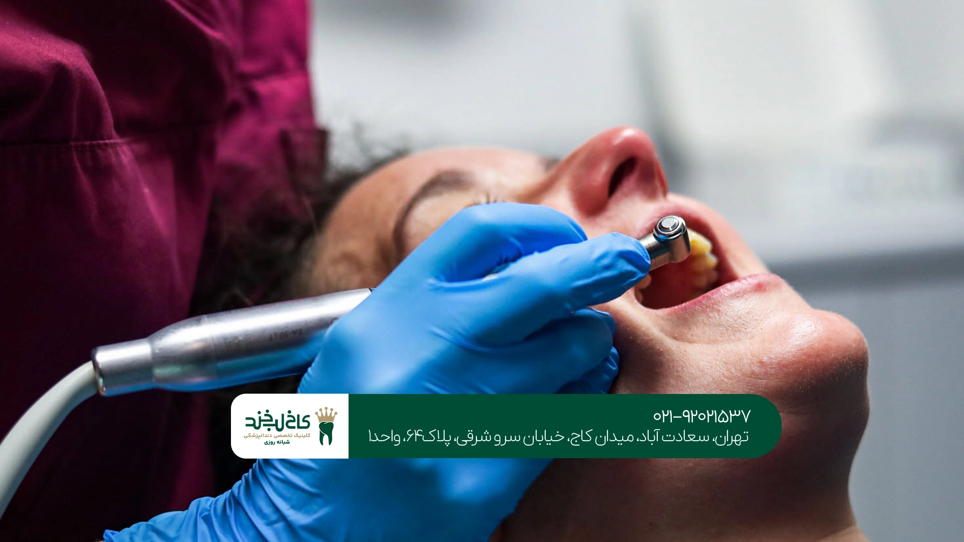 جرمگیری دندان حرفهای