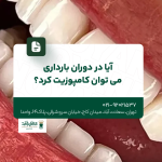 آیا در دوران بارداری میتوان کامپوزیت کرد