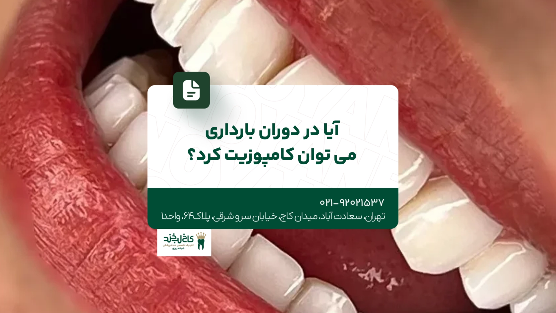 آیا در دوران بارداری میتوان کامپوزیت کرد