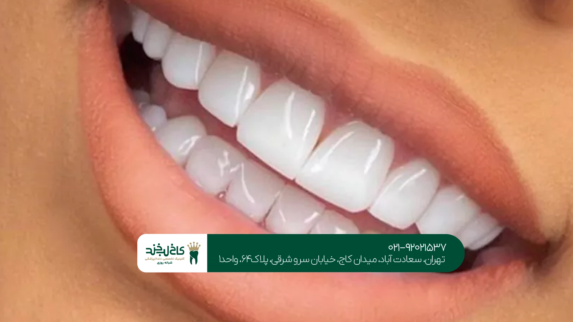آیا بارداری مانع کامپوزیت دندان است؟