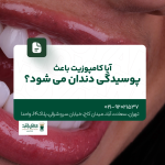 آیا کامپوزیت باعث پوسیدگی دندان می شود؟