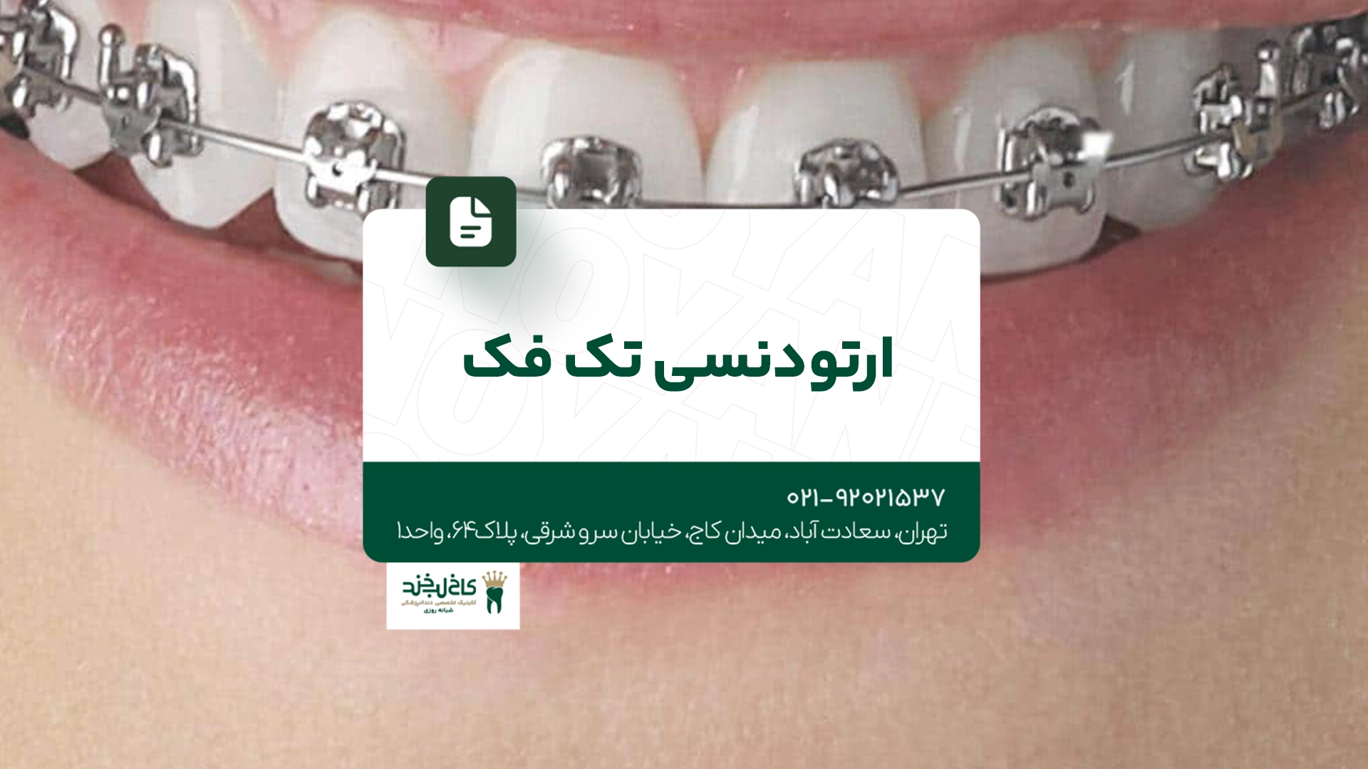 ارتودنسی تک فک ارتودنسی تک فک
