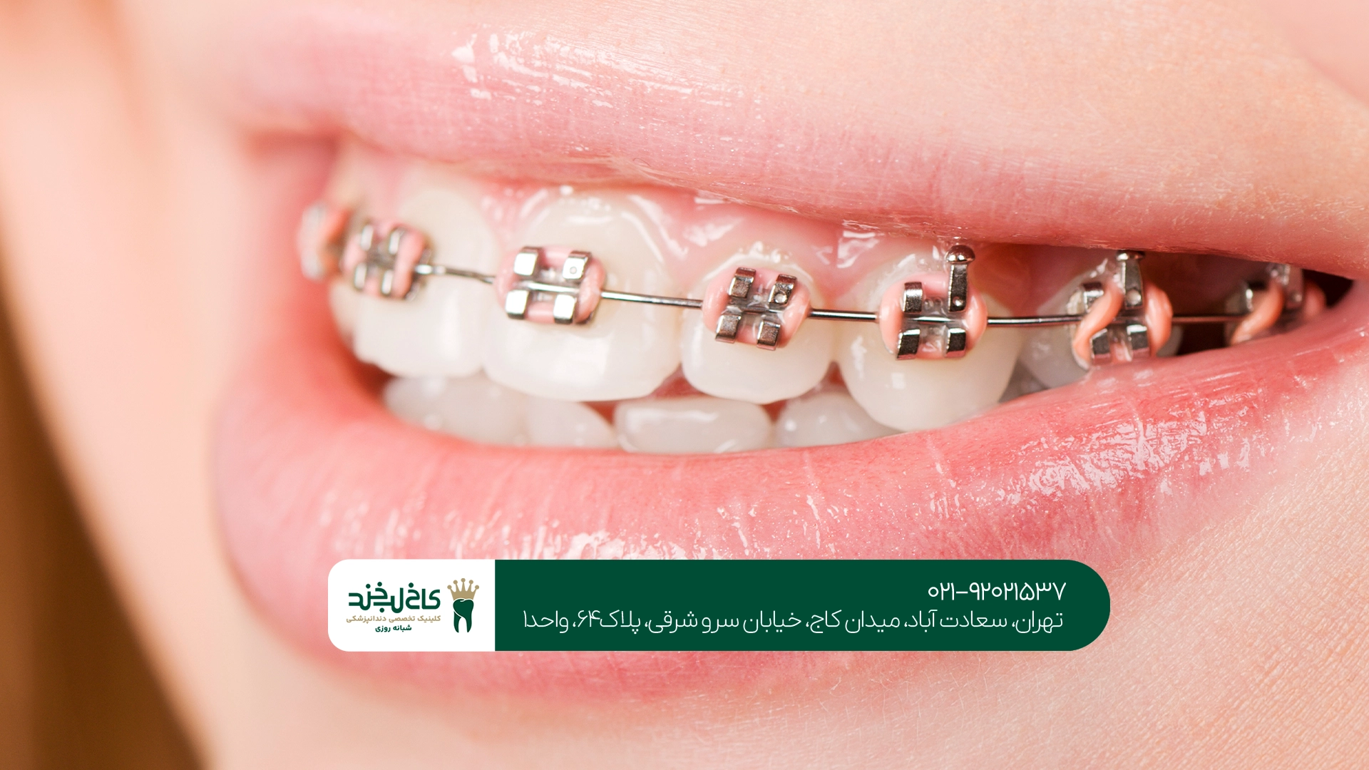 بهترین متخصص ارتودنسی در تهران بهترین متخصص ارتودنسی در تهران