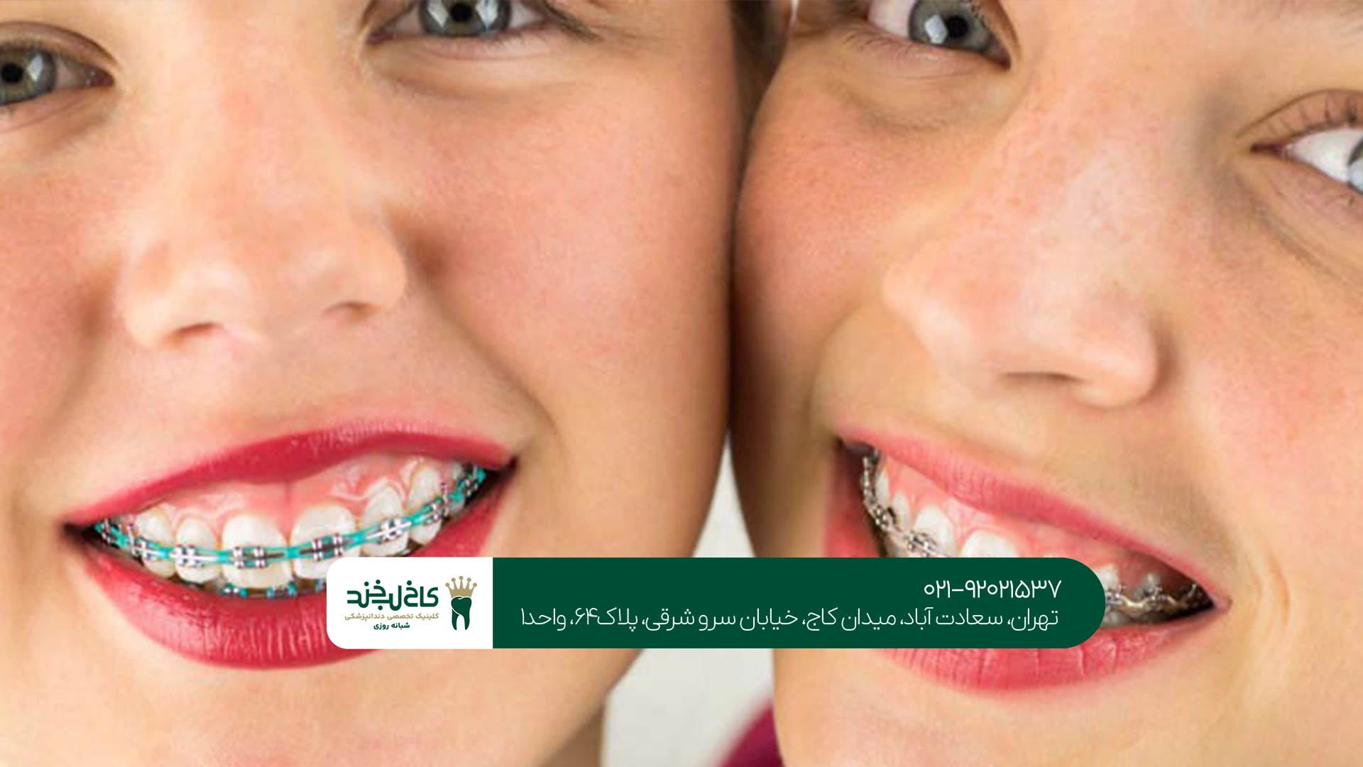 مراحل انجام ارتودنسی کودکان مراحل انجام ارتودنسی کودکان