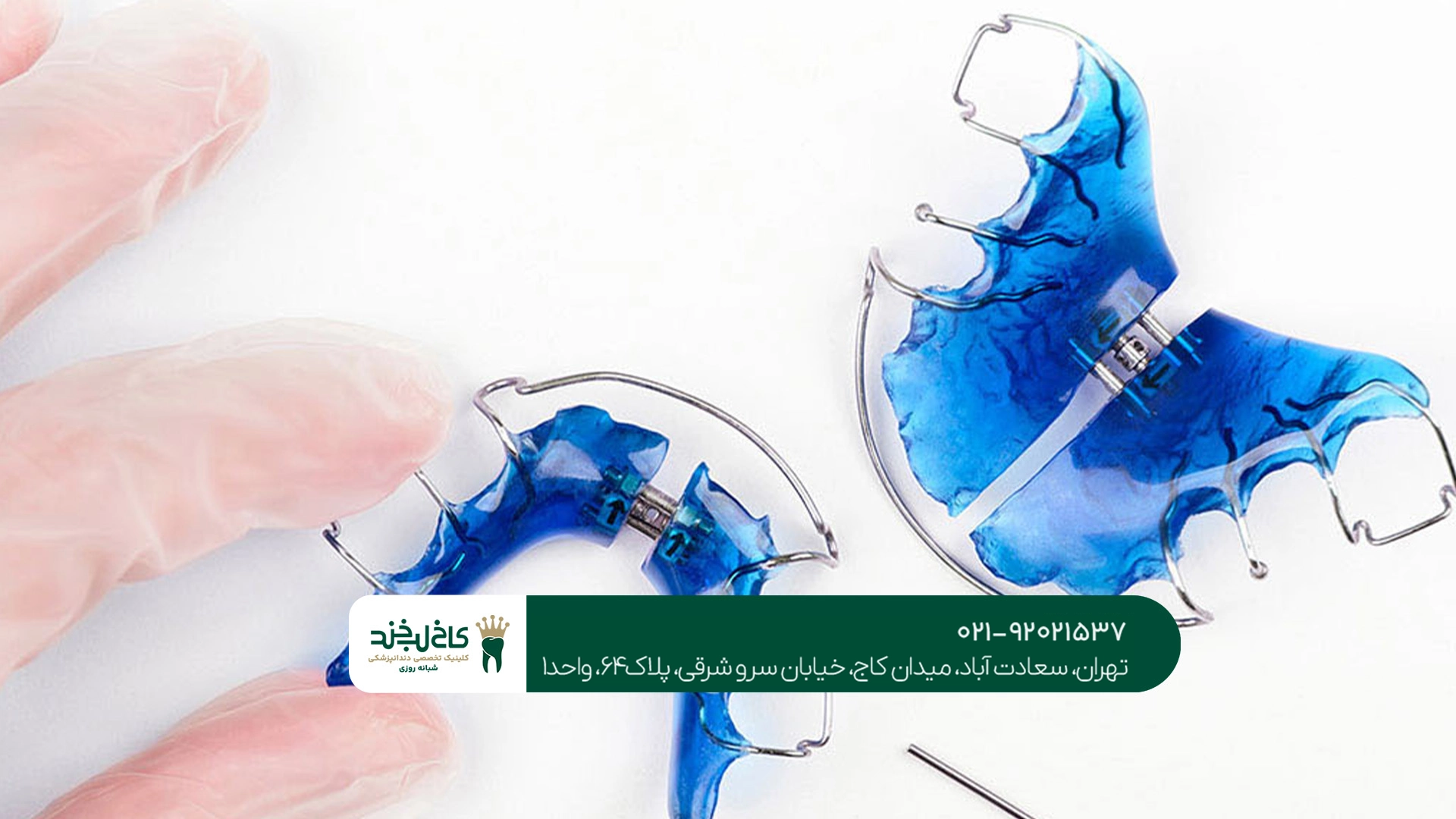 ارتودنسی دیجیتال دندان در تهران ارتودنسی دیجیتال دندان در تهران