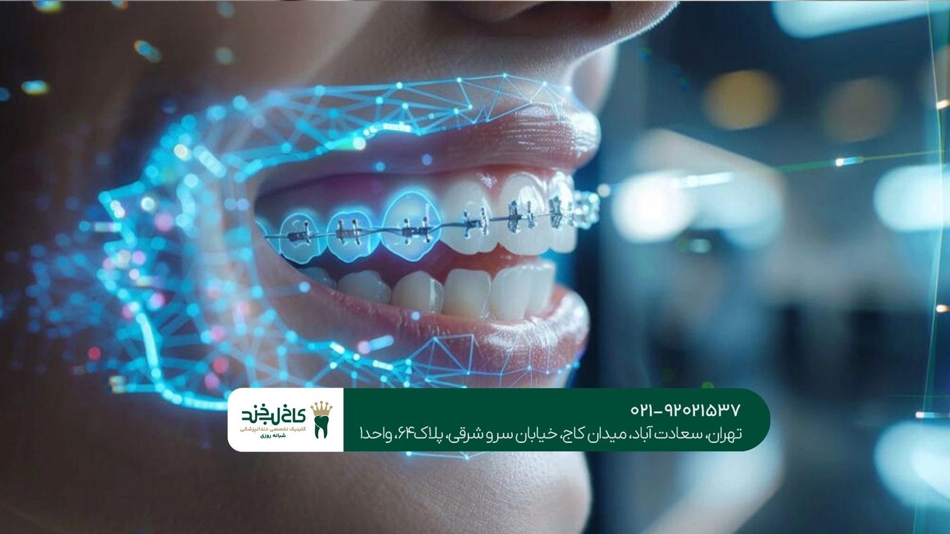 ارتودنسی دیجیتال دندان در تهران ارتودنسی دیجیتال دندان در تهران