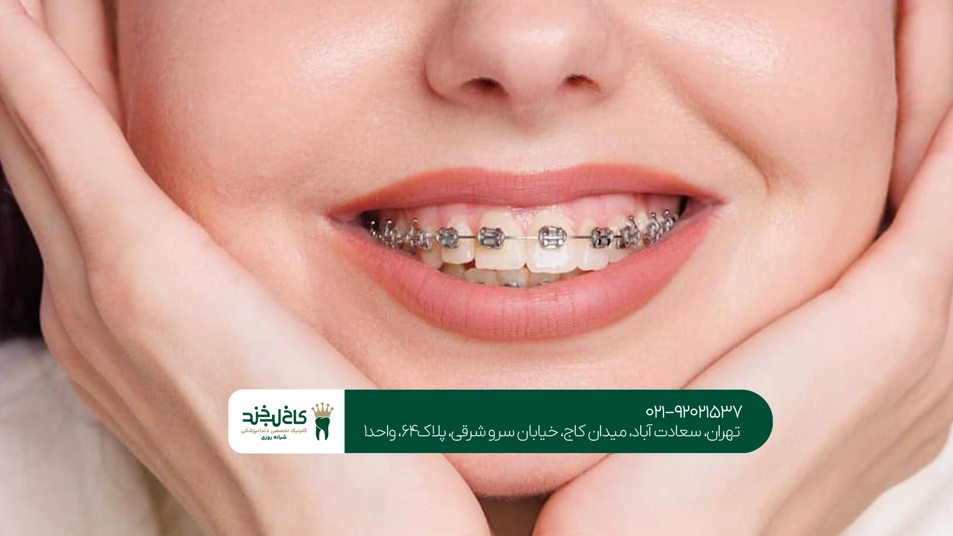 درمان ارتودنسی چقدر طول میکشد؟