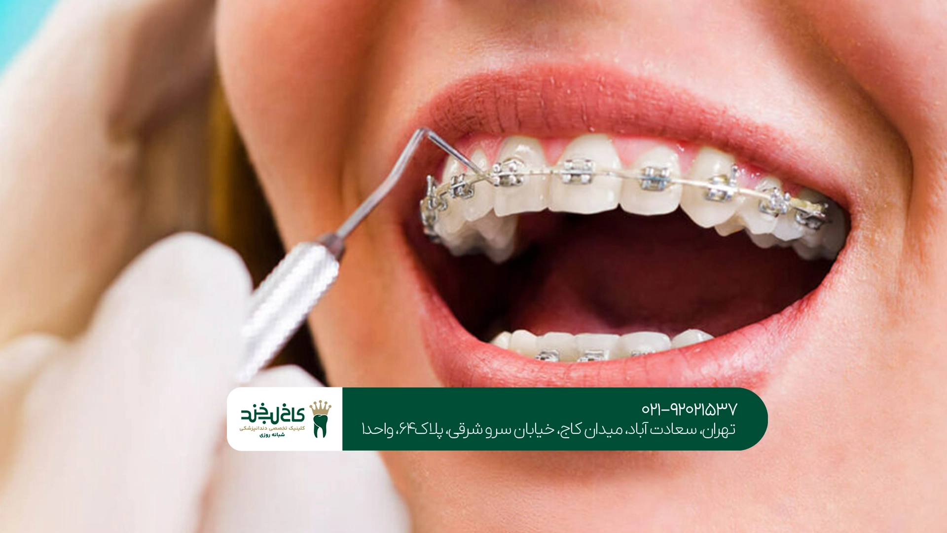 ارتودنسی نامرئی سعادت آباد