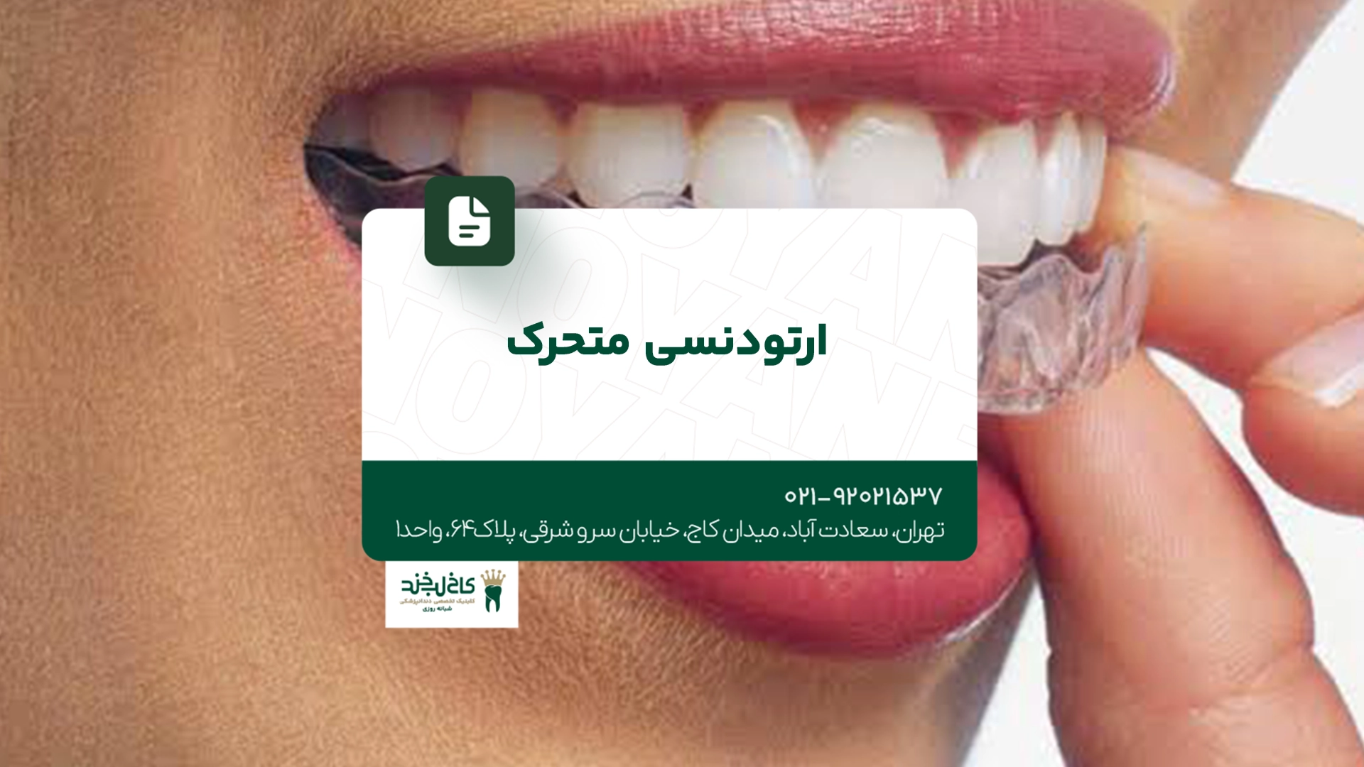 ارتودنسی متحرک ارتودنسی متحرک