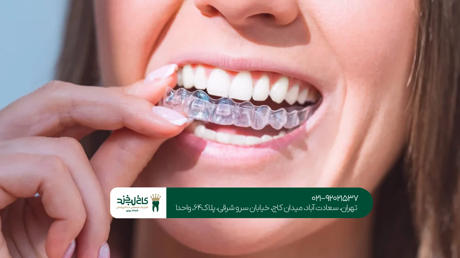 تفاوت ارتودنسی ثابت و متحرک تفاوت ارتودنسی ثابت و متحرک