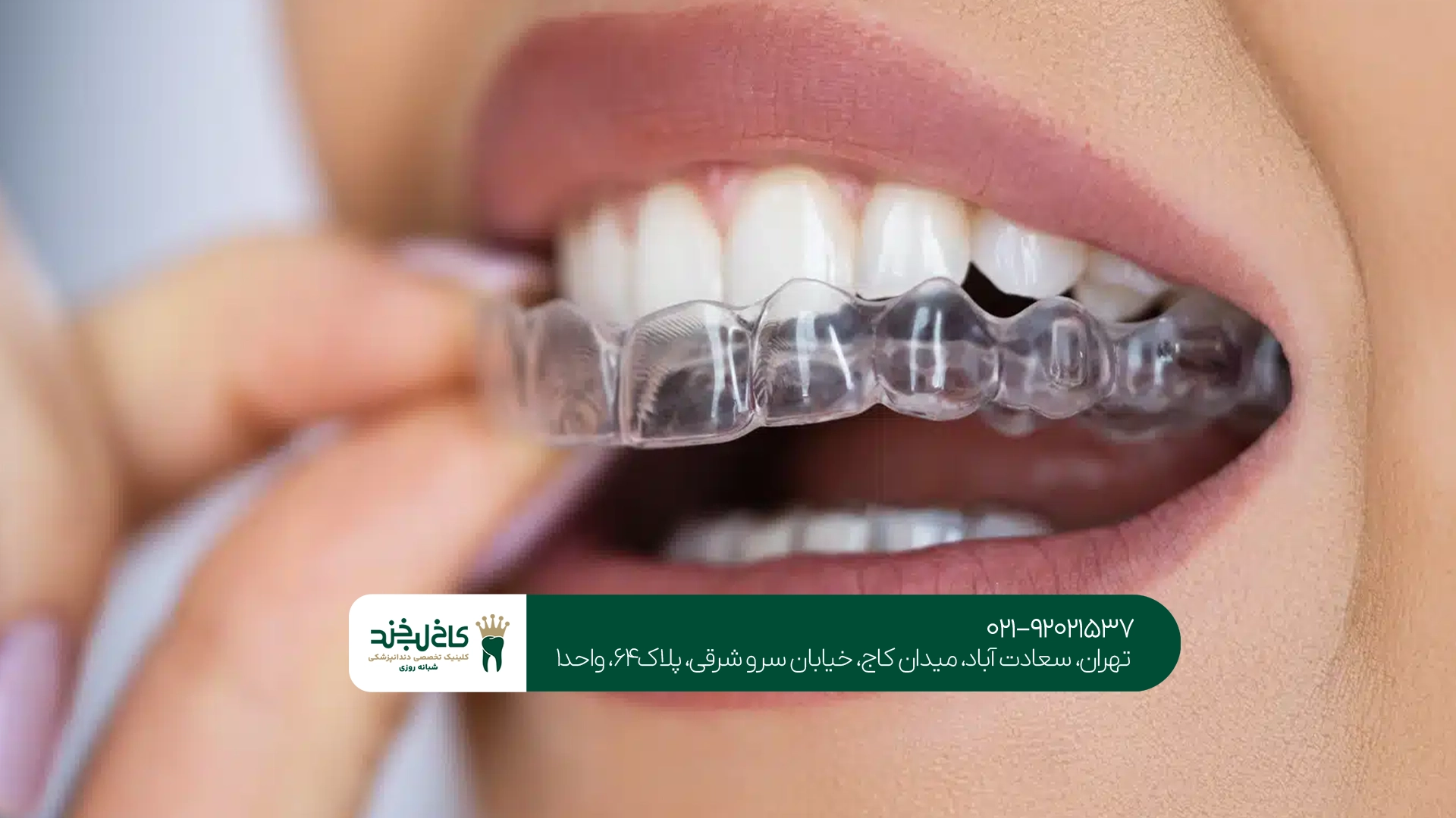 ارتودنسی متحرک کودکان ارتودنسی متحرک کودکان