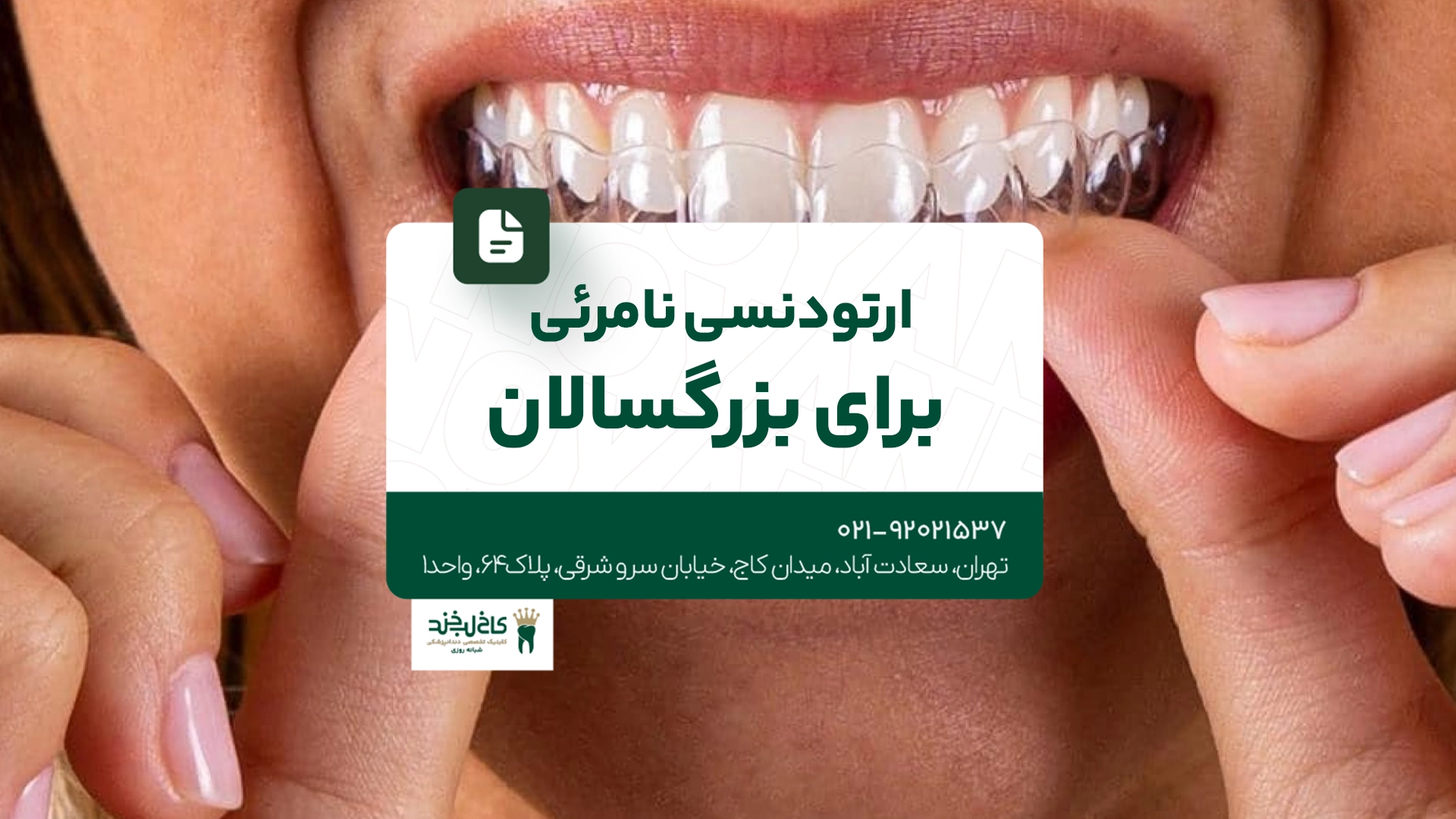 ارتودنسی نامرئی برای بزرگسالان