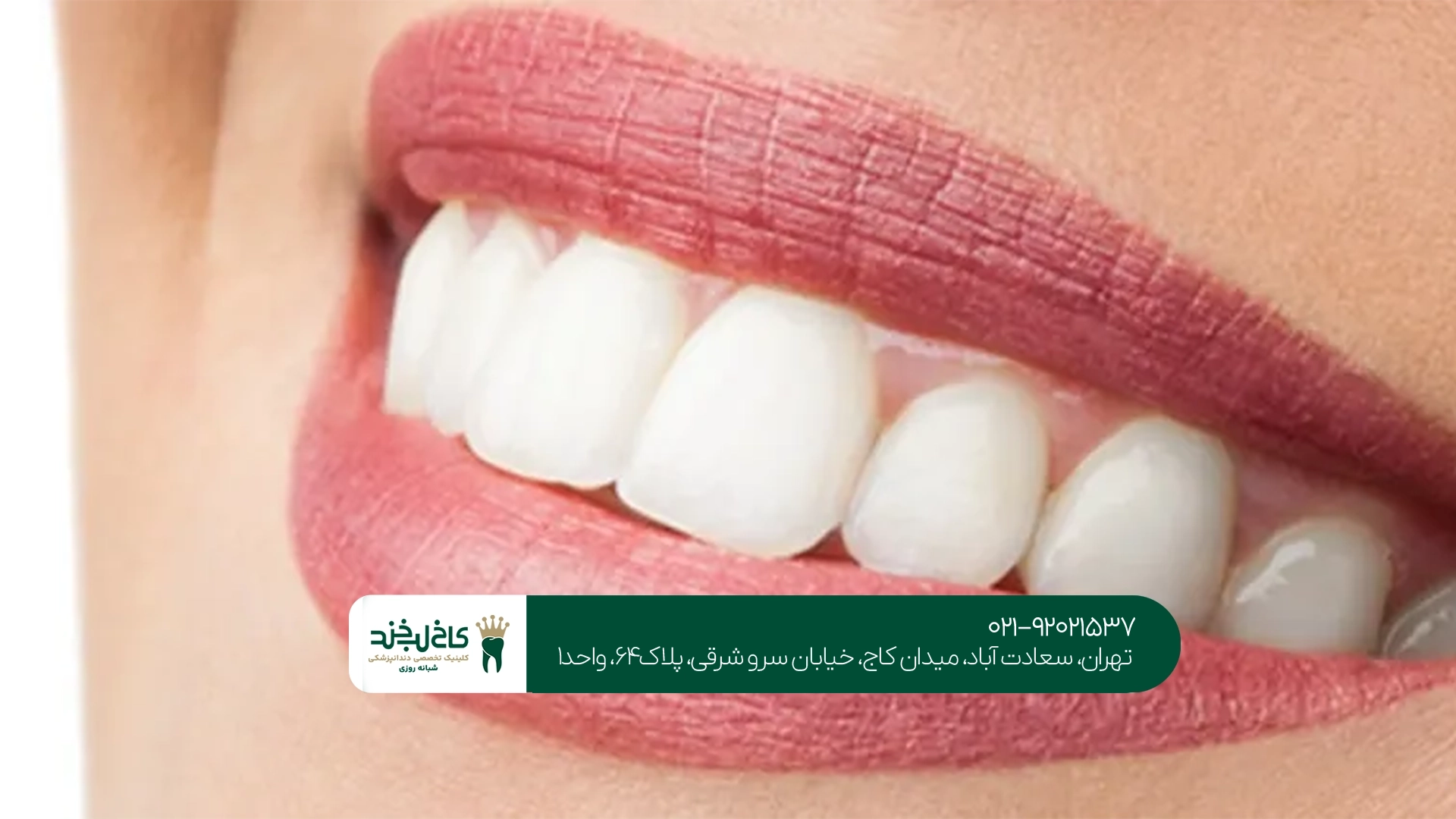 روشهای مختلف اصلاح طرح لبخند