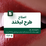 اصلاح طرح لبخند