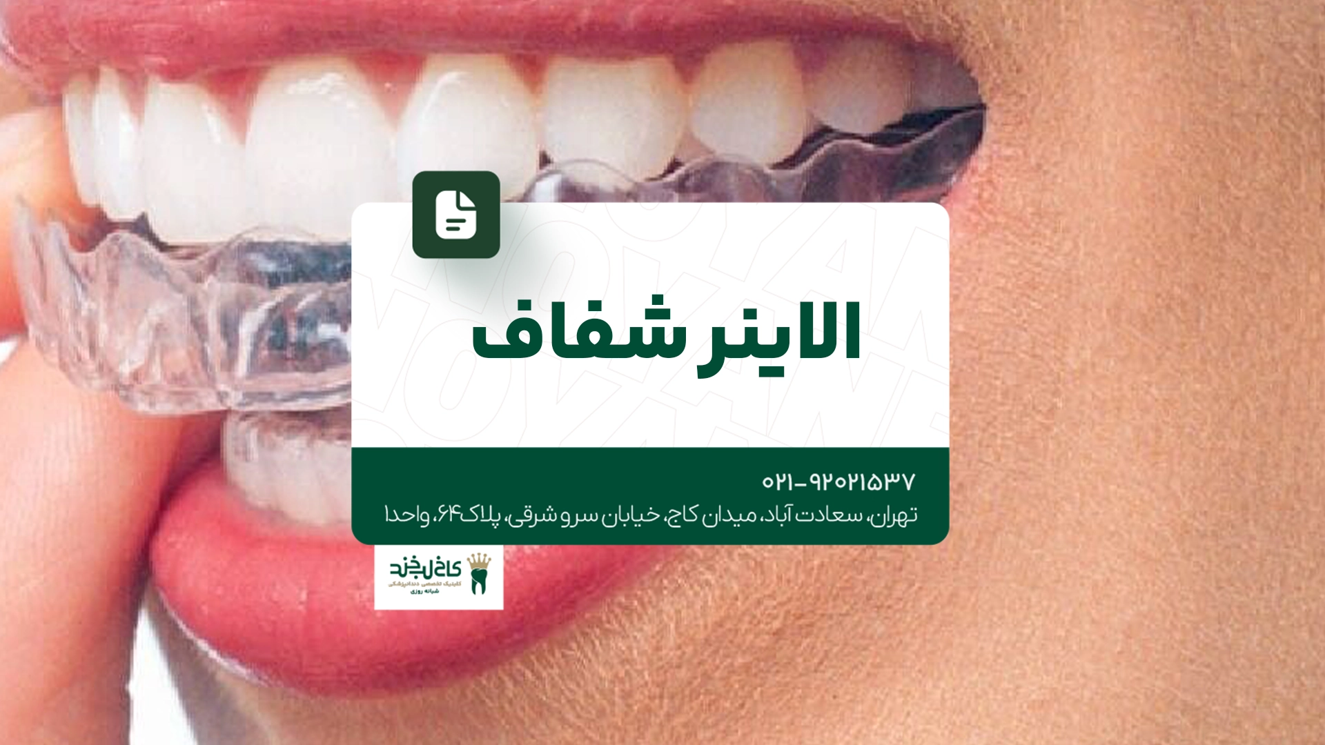 الاینر شفاف