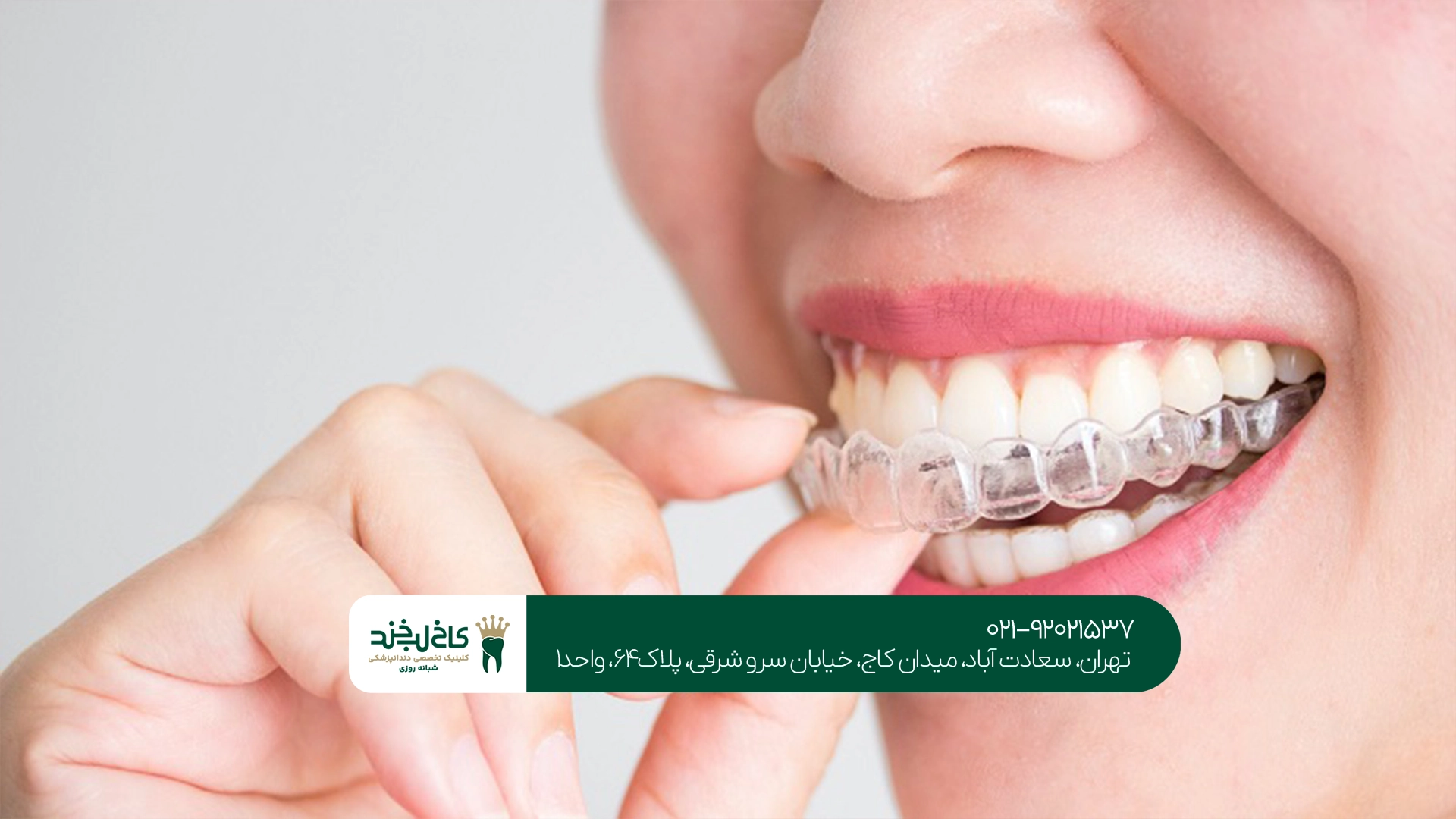 بهترین الاینر شفاف در تهران