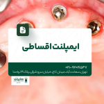 ایمپلنت اقساطی