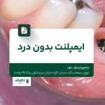 ایمپلنت بدون درد