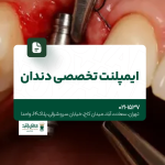 ایمپلنت تخصصی دندان