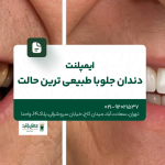 بهترین متخصص ایمپلنت دندان در سعادت آباد