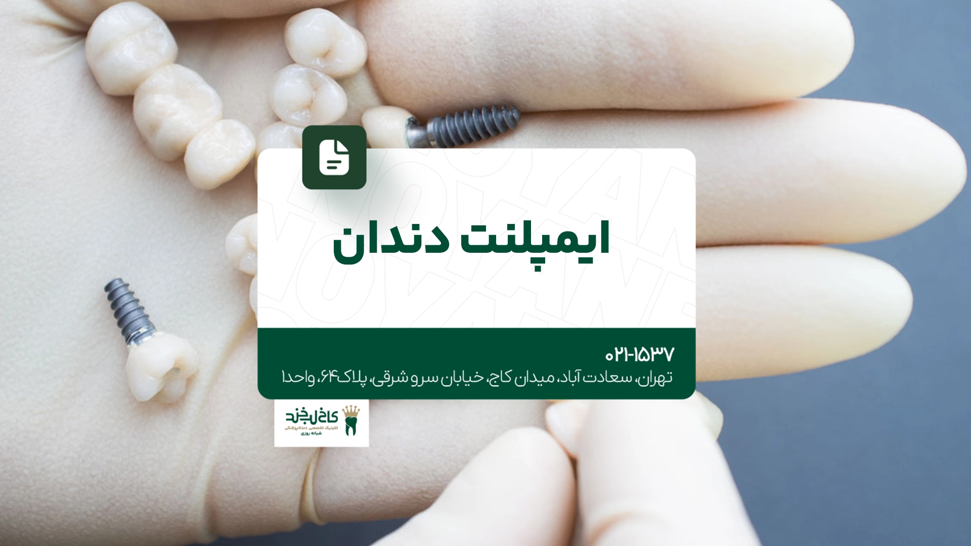 ایمپلنت دندان