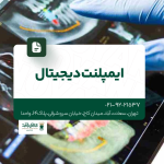 ایمپلنت دیجیتال
