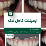 ایمپلنت کامل فک