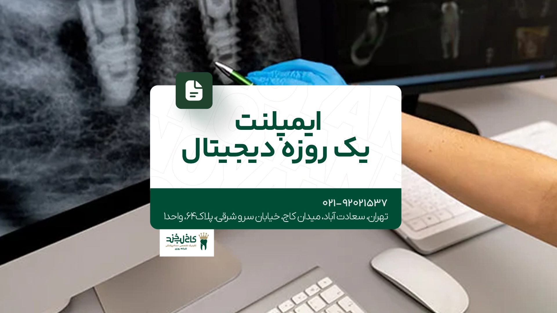 ایمپلنت یک روزه و دیجیتال