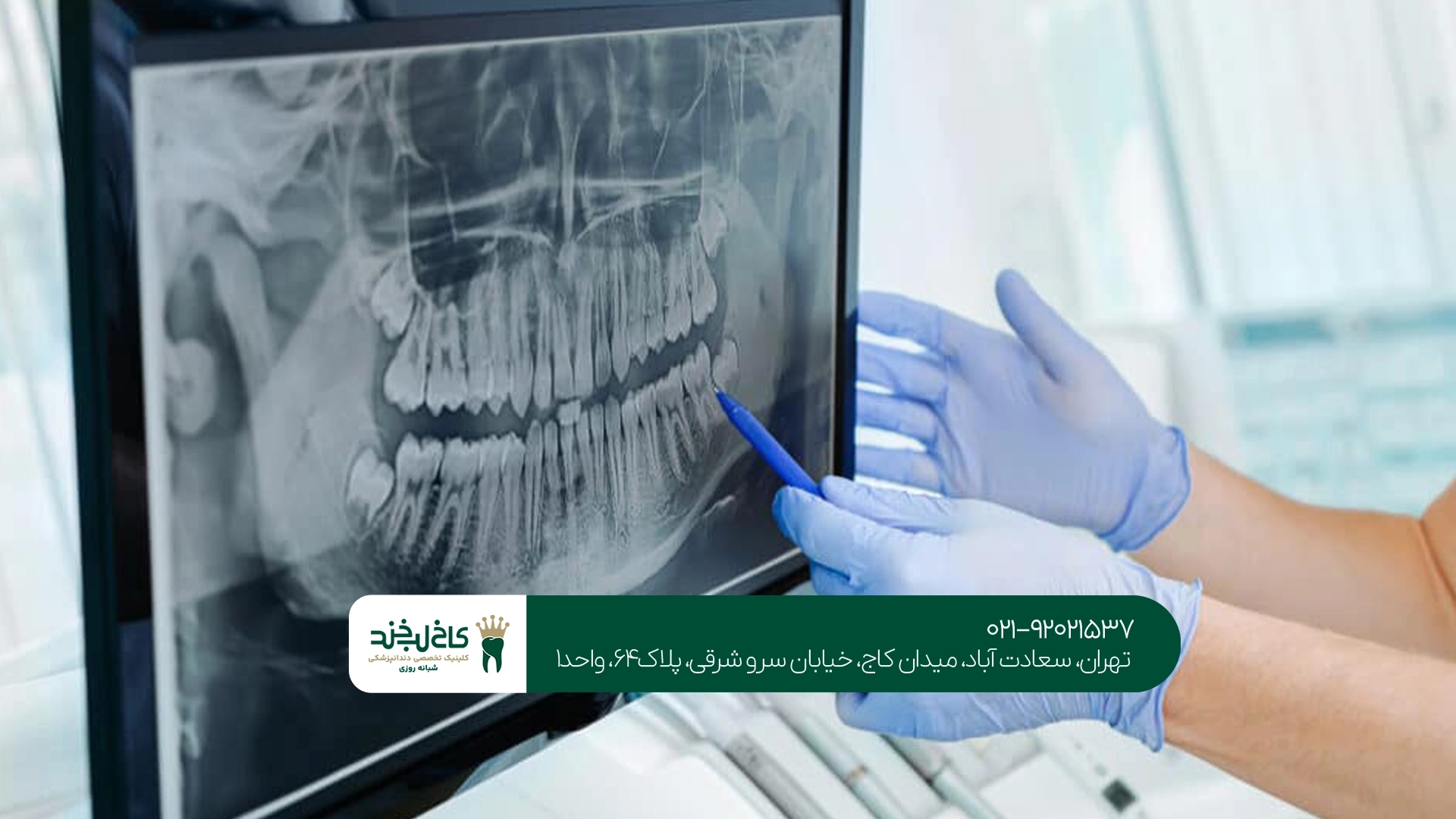 بهترین دندانپزشک ایمپلنت دیجیتال