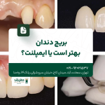 بریج دندان بهتر است یا ایمپلنت