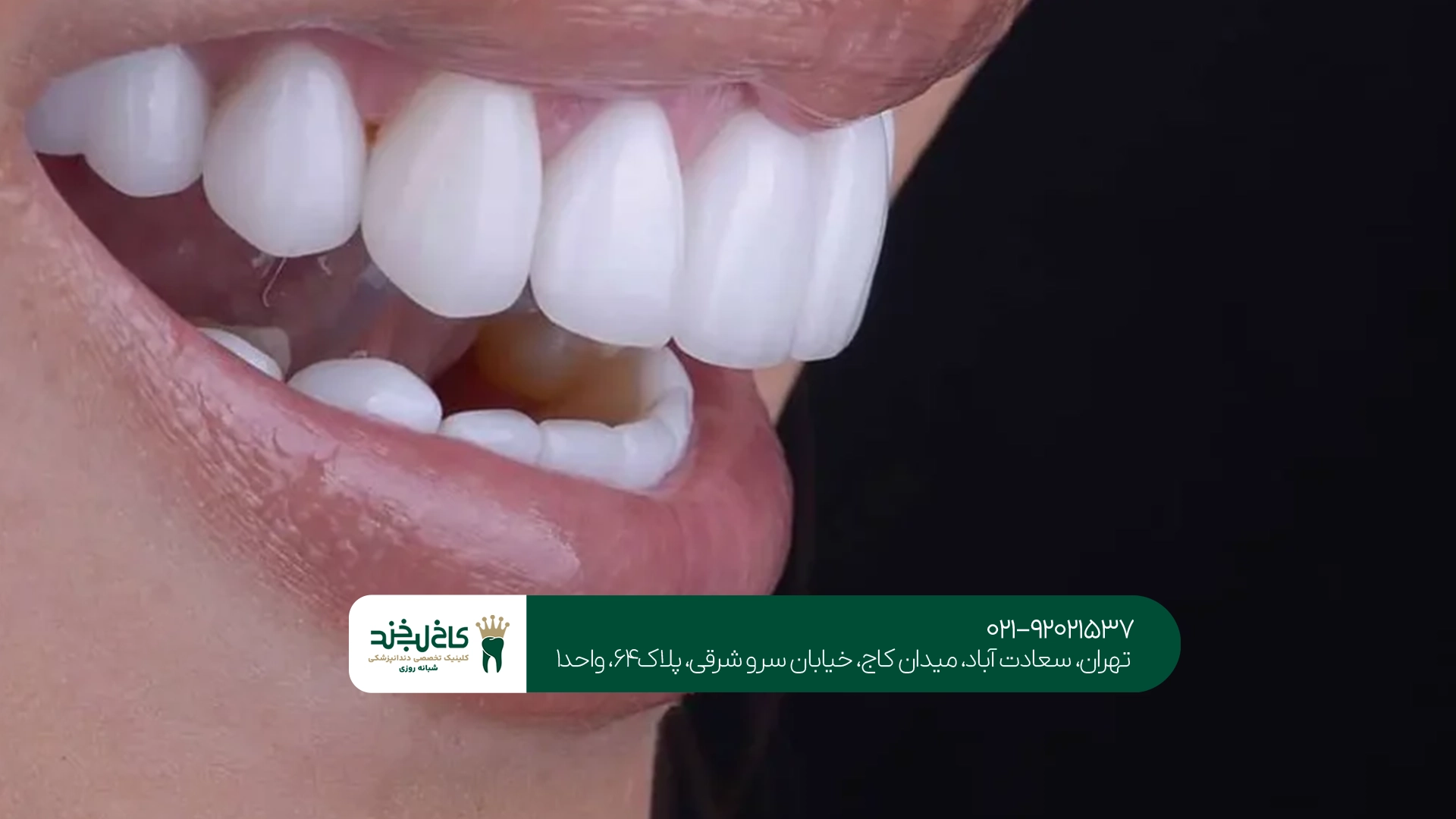 انتخاب بهترین روش زیبایی دندان