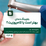 بلیچینگ دندان بهتر است یا کامپوزیت