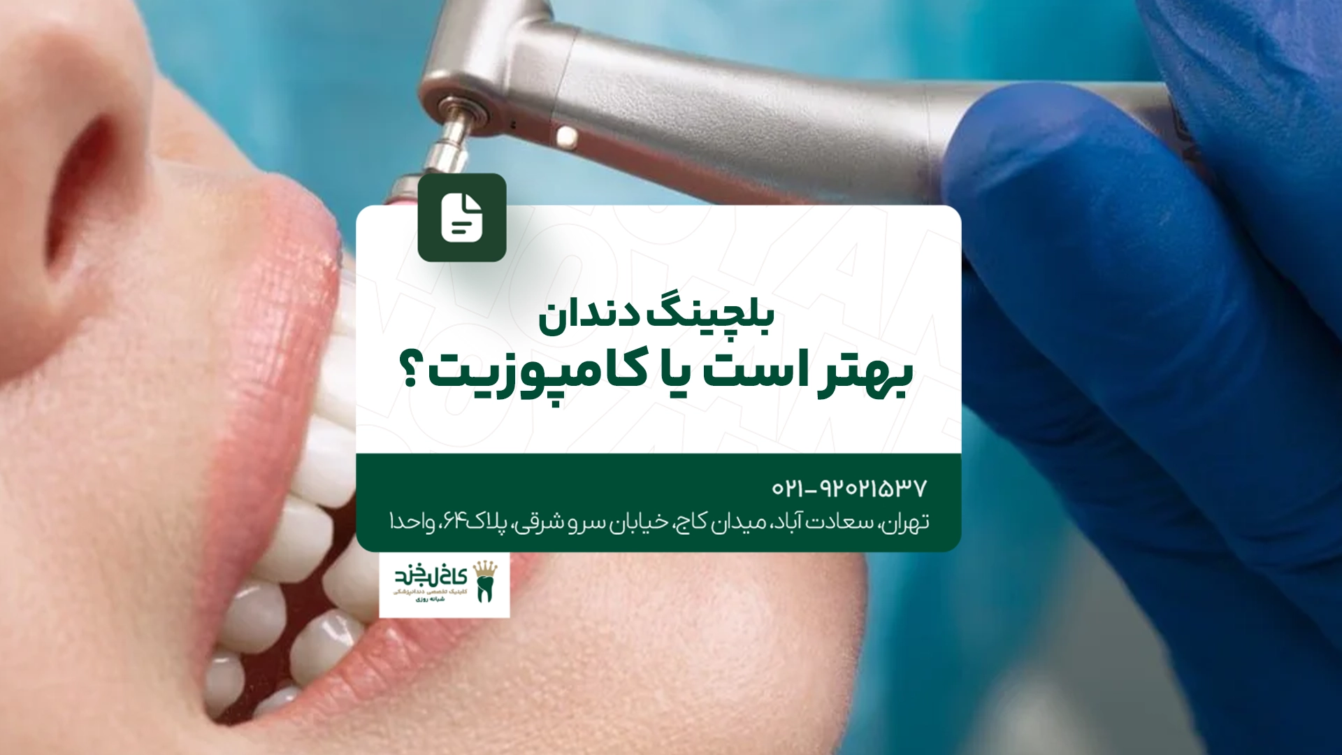 بلیچینگ دندان بهتر است یا کامپوزیت