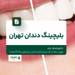بلیچینگ دندان تهران