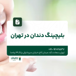بلیچینگ دندان در تهران