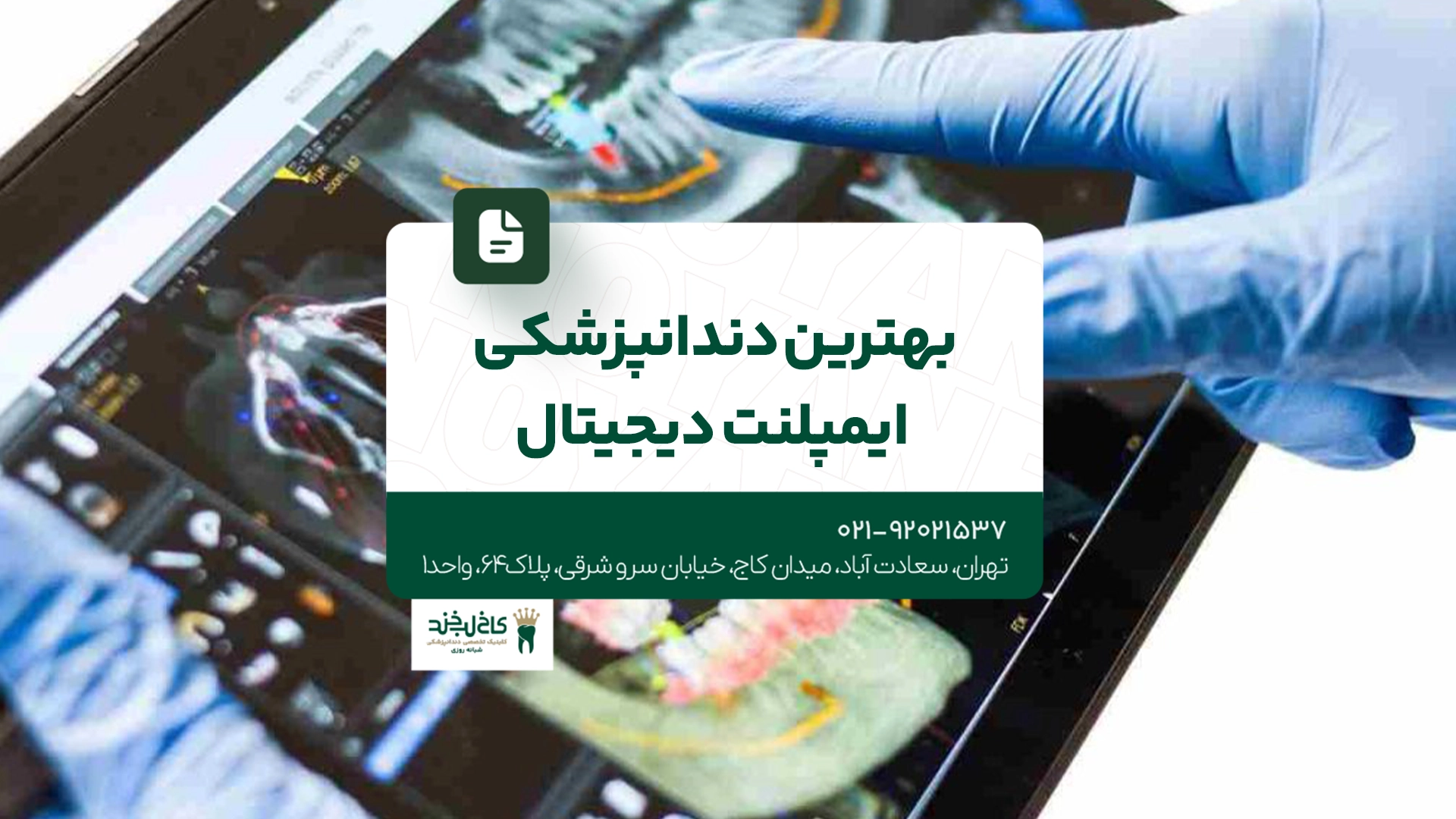 بهترین دندانپزشکی ایمپلنت دیجیتال